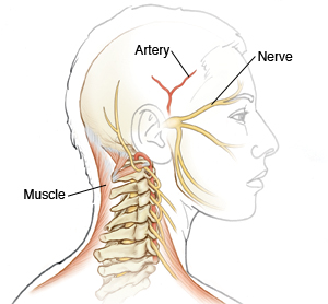 Imagen de la cabeza en donde se observan los músculos del cuello, una arteria del cerebro y los nervios faciales.