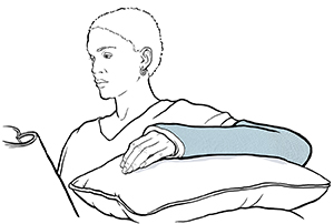 Mujer en el sofá descansa el brazo enyesado sobre almohadas.