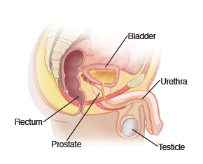Vista de la anatomía pélvica masculina, en la que pueden verse la vejiga, el recto, la próstata, un testículo y la uretra.